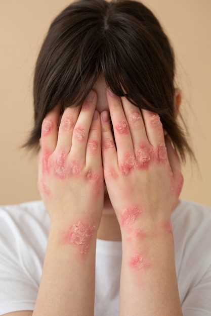 Средства, которые помогут снять аллергический зуд кожи