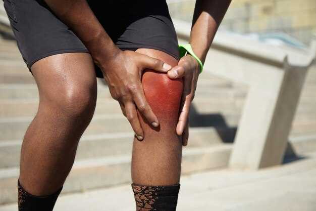 Отличия между артрозом и гонартрозом коленного сустава 2 степени