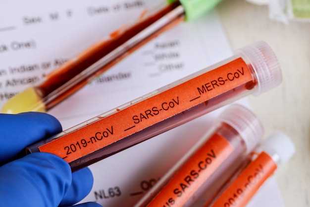 Окно обнаружения ВИЧ и сроки тестирования