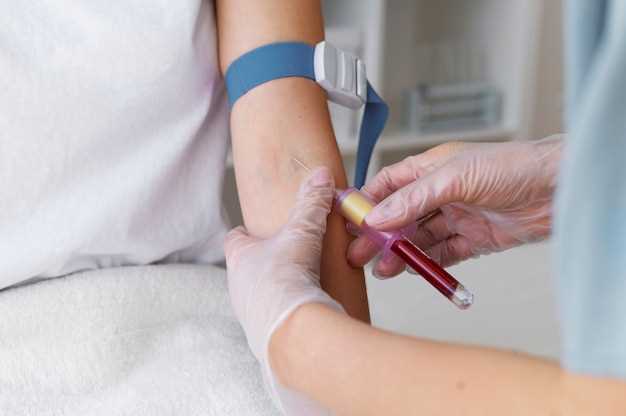 Как проходит процедура сдачи крови на антитела?