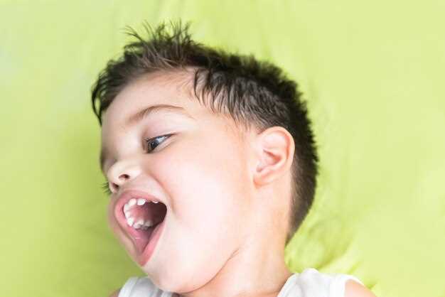 Профилактика герпеса во рту у детей