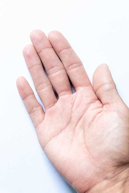Симптомы и признаки бородавок на пальцах рук