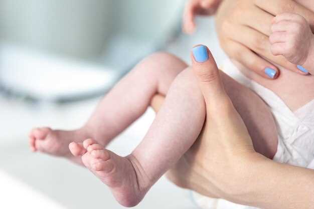 Что может вызвать крапивницу у новорожденных?