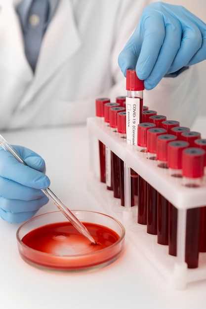 Как проводится общий анализ крови у взрослых?
