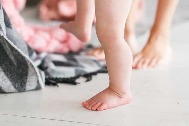 Что такое вальгусная стопа у ребенка?